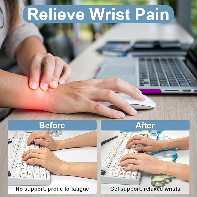 Keyboard Wrist Rest with Cloud Mouse Pad - Gradient Blue Ergonomic Gel Cloud Mouse Pad with Non-Slip Base, Cute Office Accessories for Desktop/Latop/Home/Office