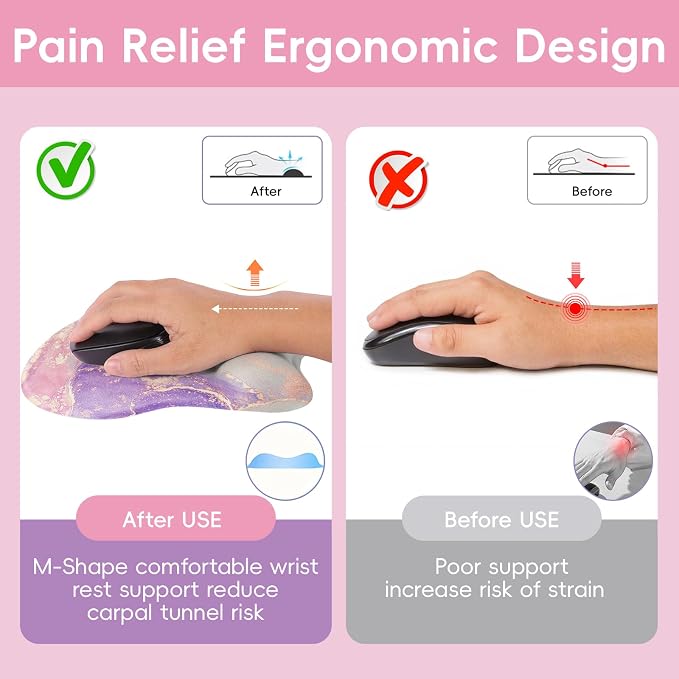 Upgrade Ergonomic Mouse Pad,Non Slip Mousepad Wrist Rest Support for Office, Computer, Laptop & Mac(B-Charming Pink Marble)