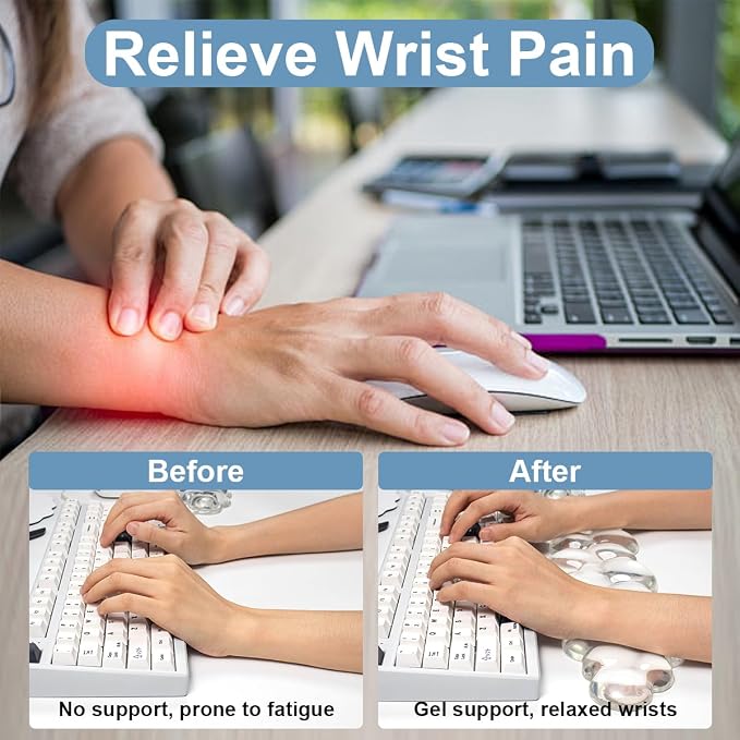 Cloud Wrist Rest for Keyboard and Mouse Set, Cooling Erogonomic Mouse Pad | Soft Comfort Pain & Fatigue Relief Easy to Clean Office Accessories